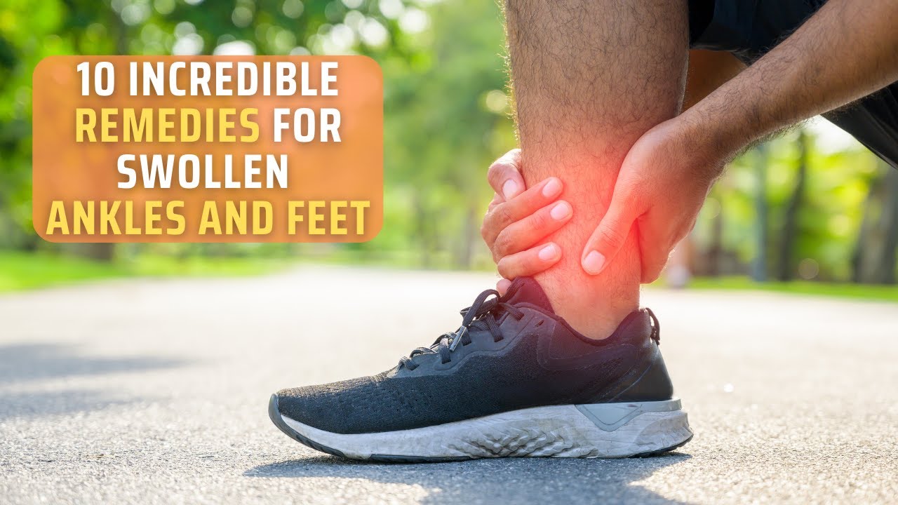 10 Incredible Remedies For Swollen Ankles And Feet Checkoutdiets 3337